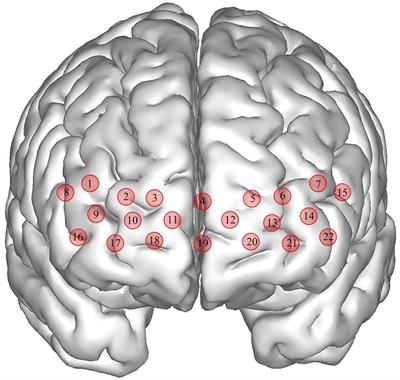 Tai Chi practice enables prefrontal cortex bilateral activation and gait performance prioritization during dual-task negotiating obstacle in older adults